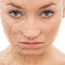 Skin Rejuvenation